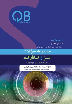 مجموعه سؤالات لنز و کاتاراکت (QBO)